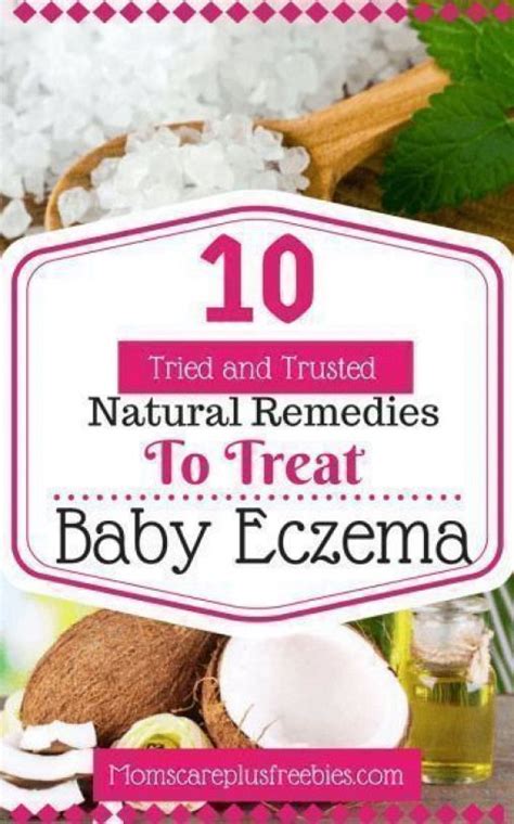 Baby Eczema Natural Remedies #babyhealth #baby #health #simple | Natural eczema remedies, Baby ...