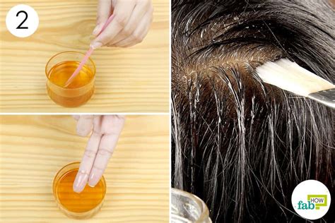 8 Best Home Remedies for Dry, Flaky Scalp That Work | Fab How