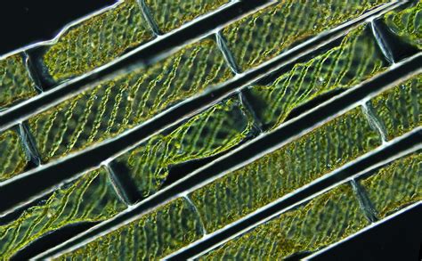 Spirogyra (green alga) with coiled chloroplasts | Nikon’s Small World