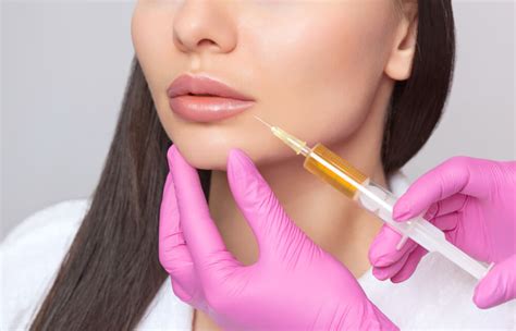 Dermal Filler Lip Injections - National Laser Institute Medical Spa