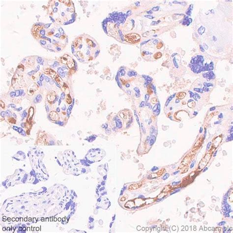 Recombinant Anti-alpha 1 Fetoprotein antibody [SP154] (ab130748) | Abcam