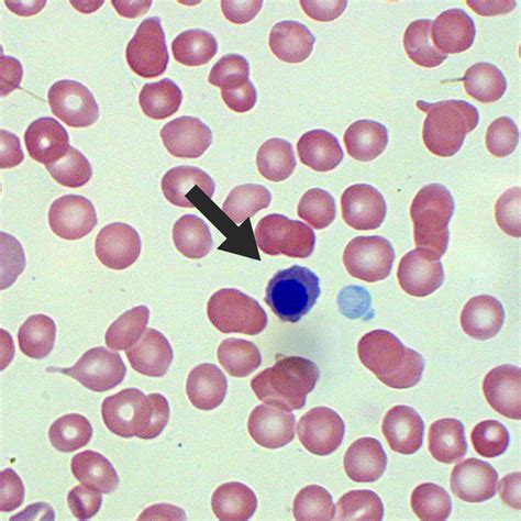 Nucleated Red Blood Cells