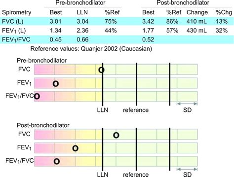 Office Spirometry in Primary Care for the Diagnosis and Management of COPD: National Lung Health ...