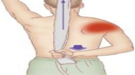 Teres Major Muscle Pain