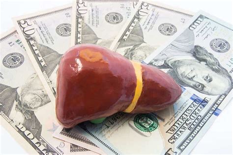 Cost Of A Liver Transplant 2023: And What You Should Know