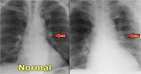 portable x ray machine ppt - Luba Rau