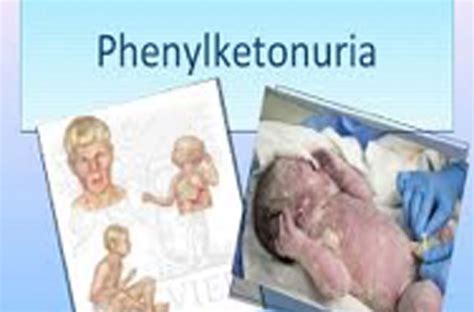 Phenylketonuria Symptoms