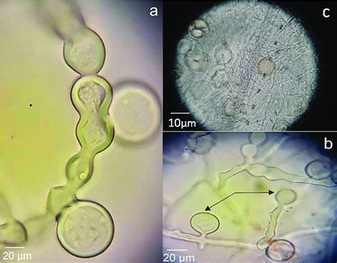 Phytophthora cinnamomi oomycete isolated from root rot of Cinnamomun ...