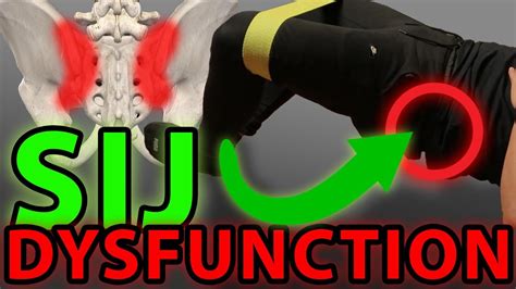 INSTANT Relief Sacroiliac Joint Exercises | SIJ Dysfunction , SIJ Pain ...