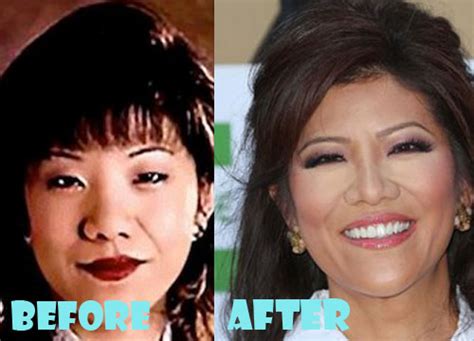 Julie Chen Plastic Surgery Before and After Nose Job - Lovely Surgery ...