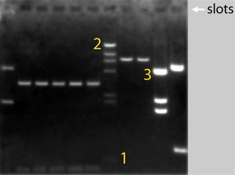 Electrophoresis