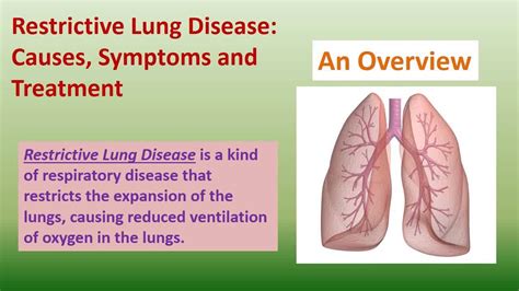 All About Restrictive Lung Disease - Hoool.com - YouTube