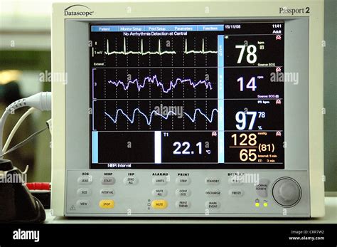 Ecg Monitor Screen