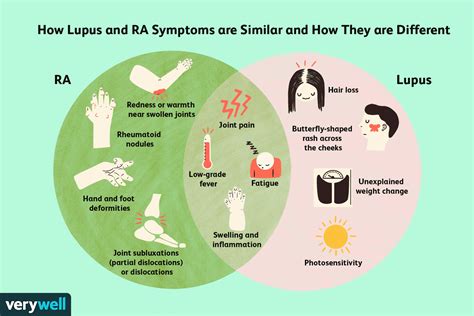 Differences Between Rheumatoid Arthritis and Lupus