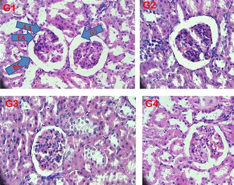 Histopathology of renal Corpuscles. EA, efferent artery; AA, afferent ...