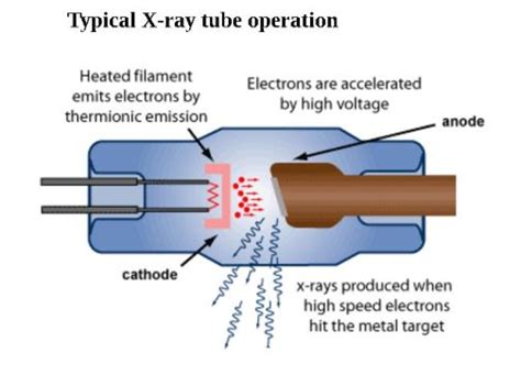 X-rays and ionizing radiation