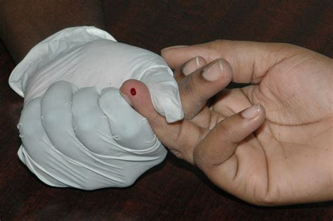 Free stock photo of blood, blood sugar, hand