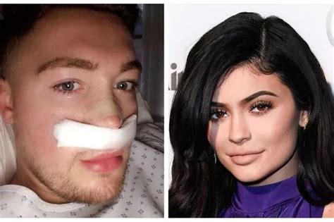 Man risks nose collapsing after £80,000 plastic surgery to look like ...