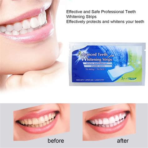 Aliexpress.com : Buy 2pcs/Set New Professional Dental Teeth Whitening Strip Tooth Whitening ...