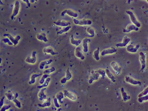 Naegleria fowleri amoeba or brain eating amoeba infection and treatment