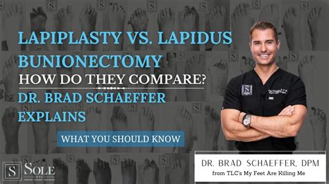 Lapiplasty Vs. Lapidus Bunionectomy: Which One Is Better? | Central ...