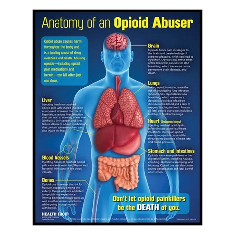 Dangers of Opioid Abuse Educational 3-D Display | Health Edco