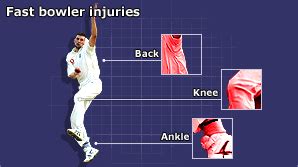 Back Injuries: Bowling Back Injuries