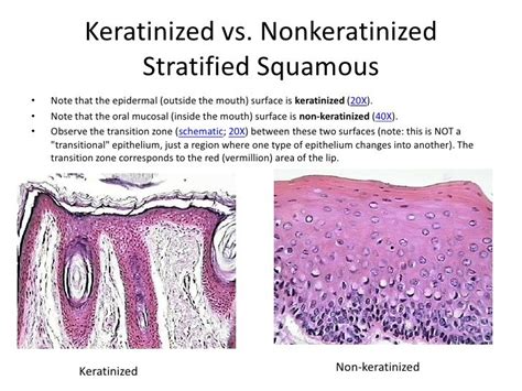 Keratinized vs. Nonkerantinized Stratified Squamous