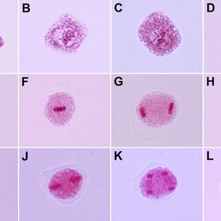 Stages of microsporogenesis in S. sangaria. (A) microspore mother... | Download Scientific Diagram