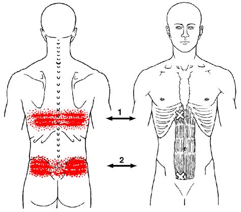 What Causes A Wide Band Of Pain In Your Back | SIMPLE BACK PAIN RELIEF | SimpleBackPainRelief.com