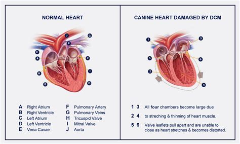 Congestive Heart Failure Diagram