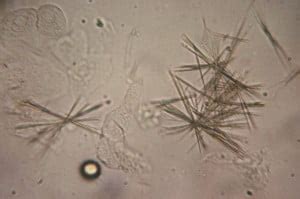 33 HQ Images Struvite Crystals In Cats : Feline Struvite Calcium Oxalate Urolithiasis Today S ...