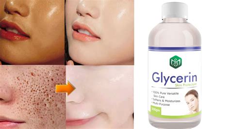 How to use glycerin for skin lightening | Glycerin for face whitening | Glycerin for skin - YouTube