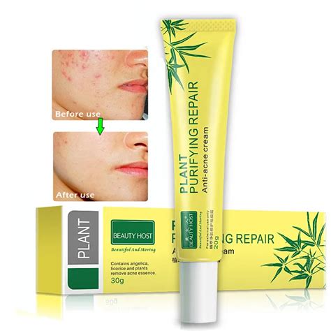 Original Acne Cream Acne Scar Treatment Anti Acne Cleaning Pimple ...