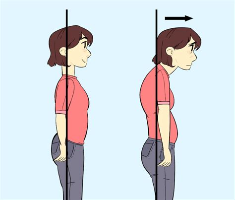 Forward Head Posture – A Pain In The Neck – ThreeSixty Osteopathy