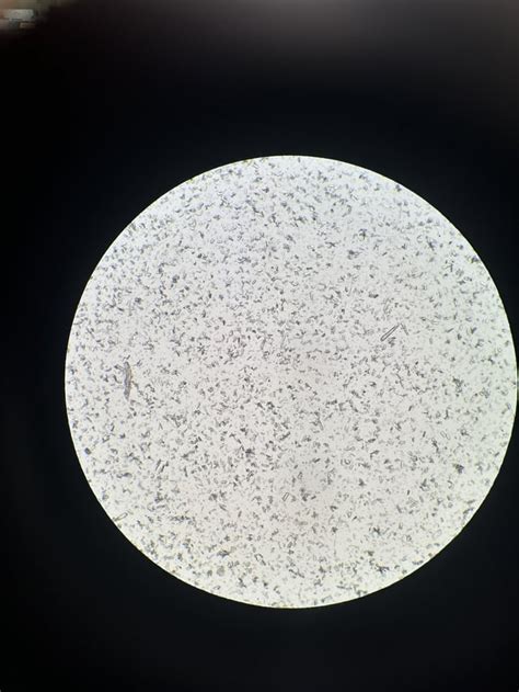 You’ve got some urine in your triple phosphate crystals : r/medlabprofessionals