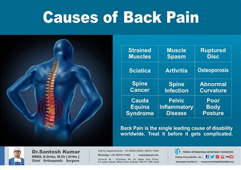 Lower Back Pain Diagnosis Chart