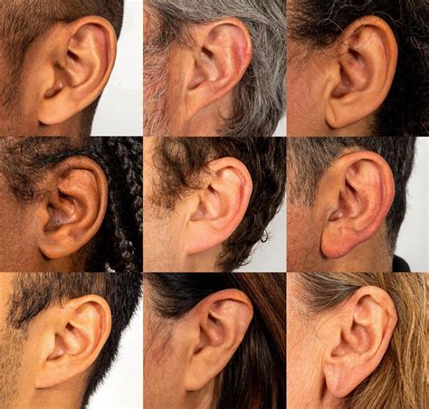 Attached and Detached Earlobes: The Curious Genetics Behind Your Ears