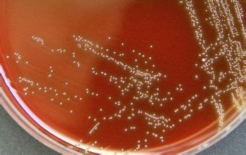 Aerococcus urinae