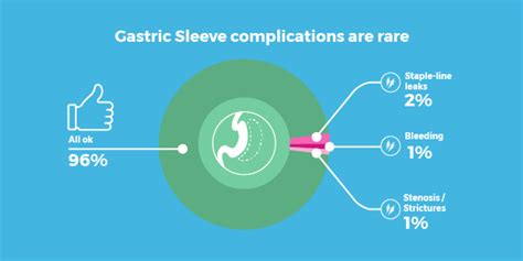 Gastric Sleeve Complications & Side Effects - The 5 Most Common - Bariatric Surgery Source