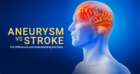 How to Differentiate Aneurysm from Stroke