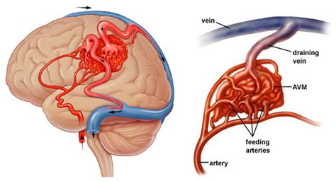 Vascular System Brain