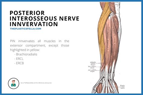 Anterior Interosseous Nerve Syndrome