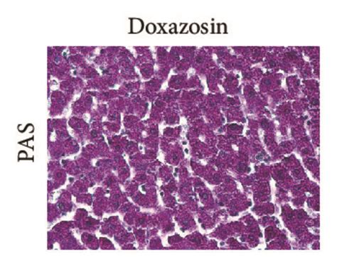 Analysis of the histological structure of the hepatic parenchyma after ...