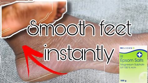 Home remedies to remove dead skin from feet – Artofit