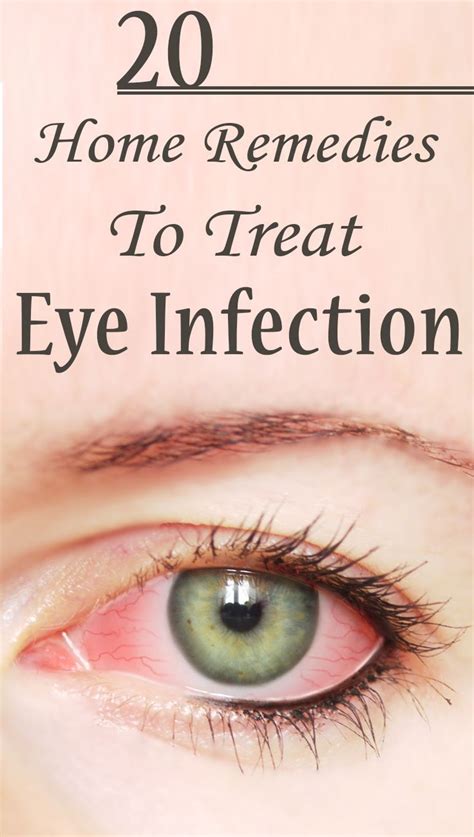 Home Remedies For Eye Infectionzip Eye Infections