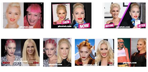 Gwen Stefani Plastic Surgery Before And After