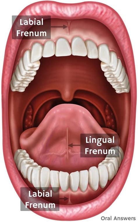 What a Frenectomy is and Why Your Child Might Need One | Oral Answers