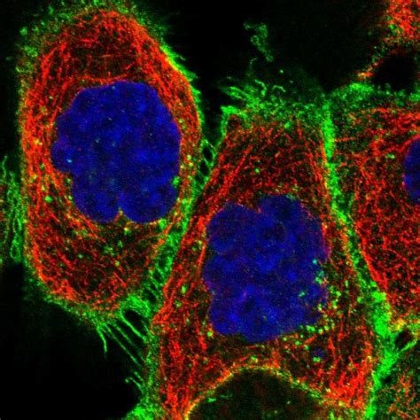 CD47 - Antibodies - The Human Protein Atlas