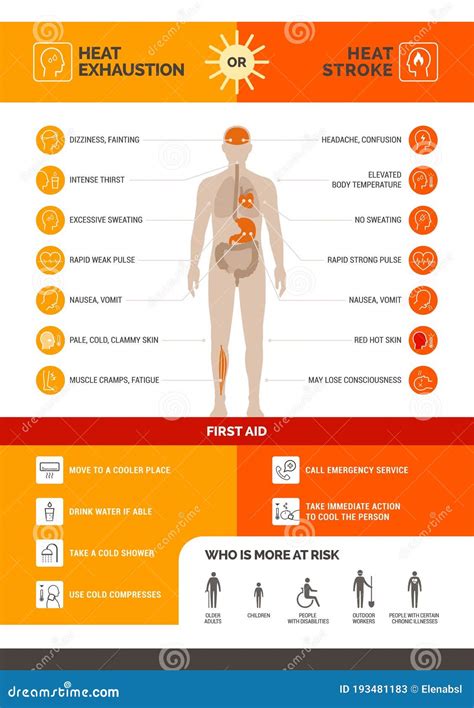 Infografía De Agotamiento Térmico Y Apoplejía De Calor Ilustración del Vector - Ilustración de ...